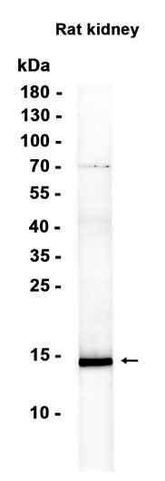 Recombinant Cystatin A Monoclonal Antibody (AGEL6434)