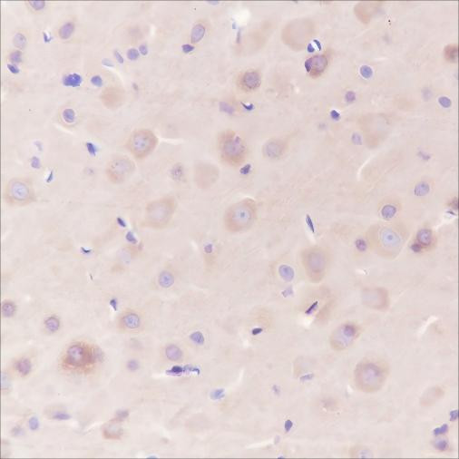 Recombinant Dynamin 1 Monoclonal Antibody (AGEL6437)