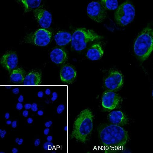 Recombinant Dynamin 1 Monoclonal Antibody (AGEL6437)