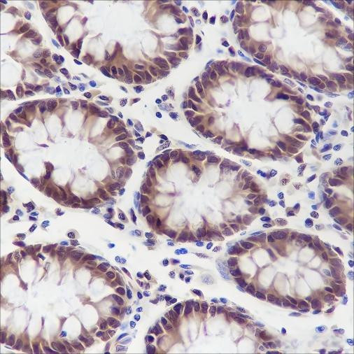 Recombinant DYNLL1 Monoclonal Antibody (AGEL6438)