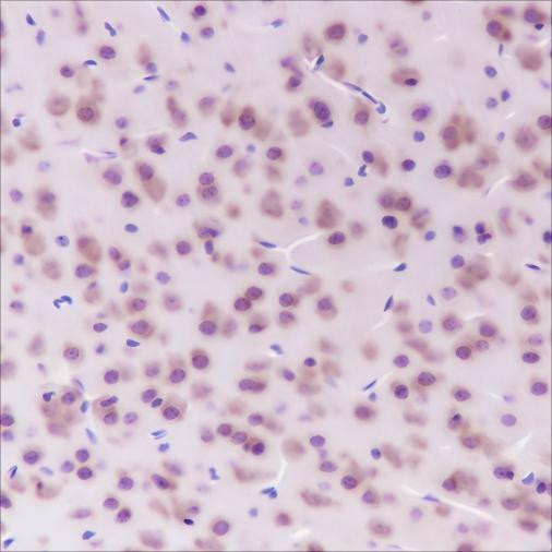 Recombinant eEF1G Monoclonal Antibody (AGEL6439)