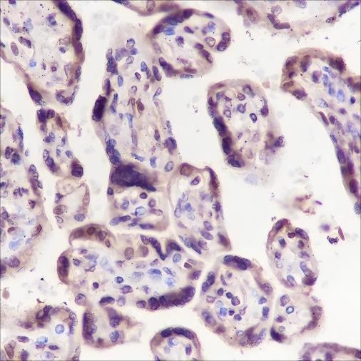 Recombinant eEF1G Monoclonal Antibody (AGEL6439)