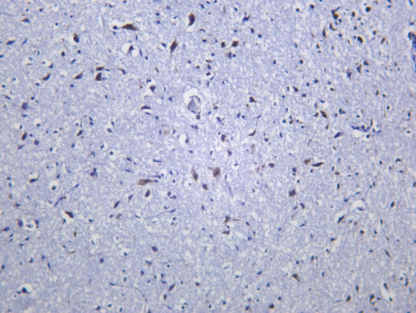 Recombinant EIF2S1 Monoclonal Antibody (AGEL6441)