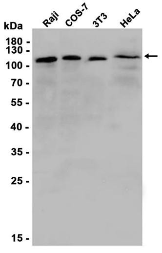 Recombinant eIF3B Monoclonal Antibody (AGEL6442)