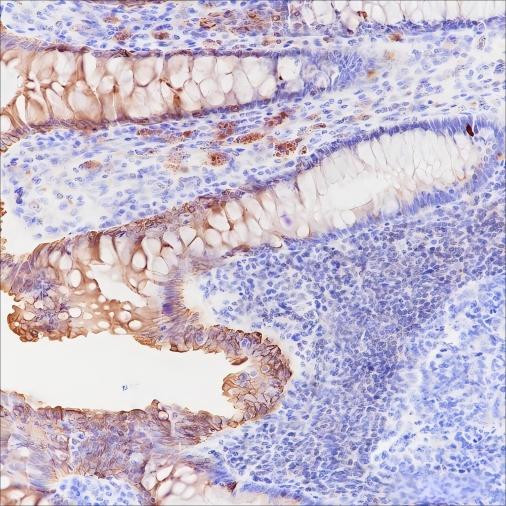 Recombinant c-erbB-3/HER-3 Monoclonal Antibody (AGEL6445)