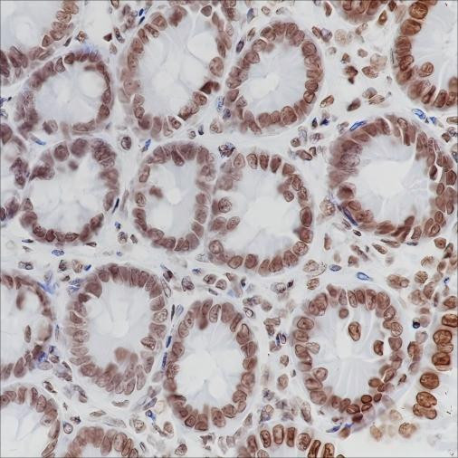 Recombinant ERCC1 Monoclonal Antibody (AGEL6446)