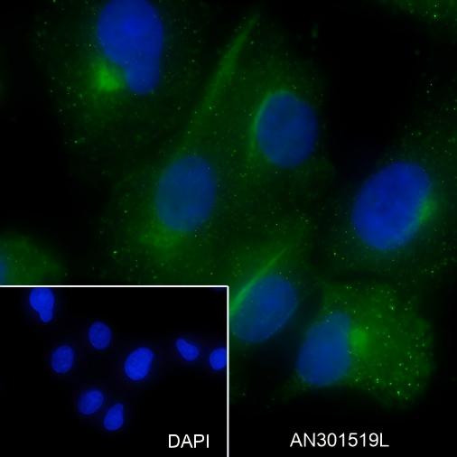 Recombinant Factor XIIIa Monoclonal Antibody (AGEL6448)