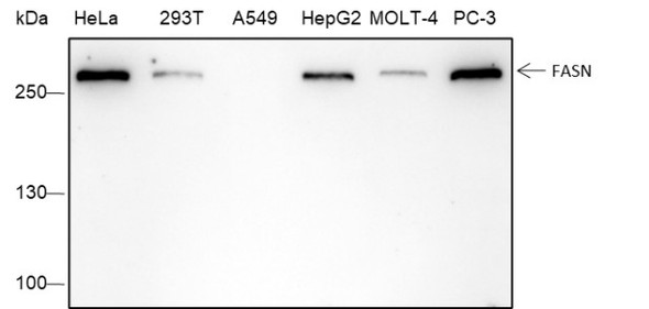 Recombinant FASN Monoclonal Antibody (AGEL6449)