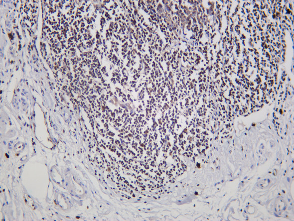 Recombinant FLI1 Monoclonal Antibody (AGEL6452)