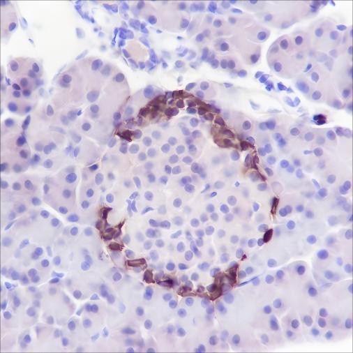 Recombinant GLP-1 Monoclonal Antibody (AGEL6459)