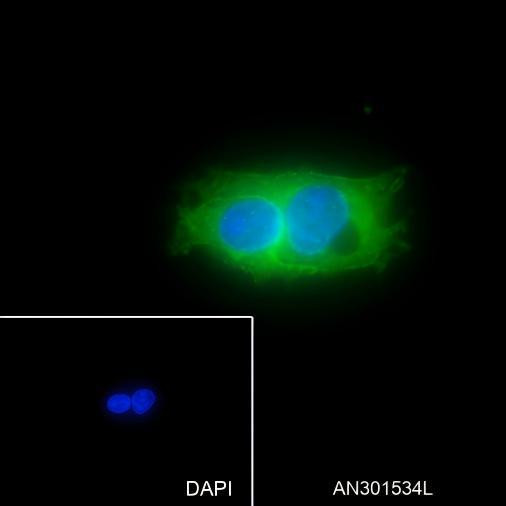 Recombinant Glypican 3 Monoclonal Antibody (AGEL6463)