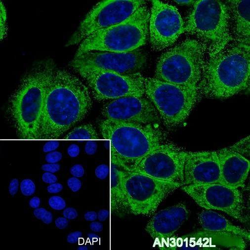 Recombinant GRP94 Monoclonal Antibody (AGEL6471)