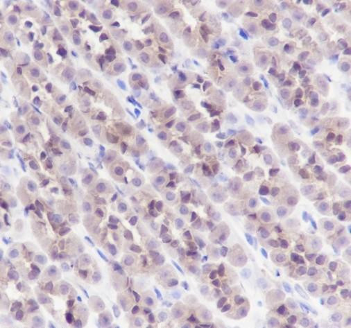Recombinant GST3/GSTP1 Monoclonal Antibody (AGEL6472)