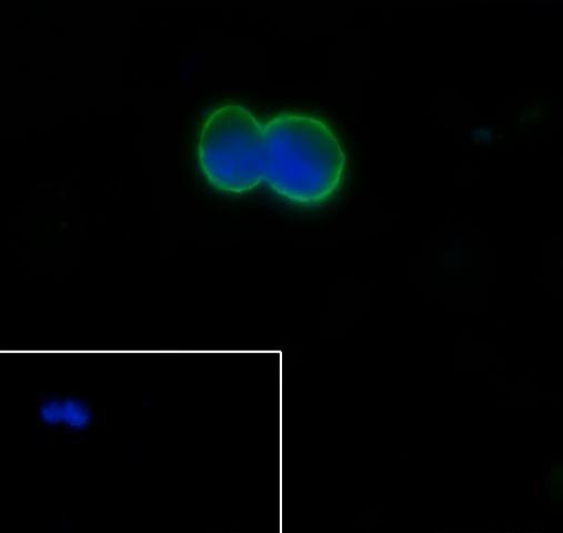 Recombinant GST3/GSTP1 Monoclonal Antibody (AGEL6472)