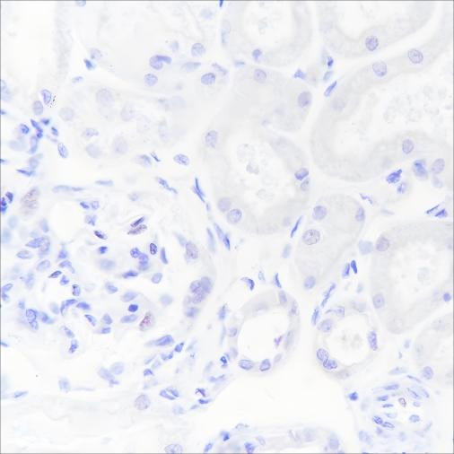 Recombinant hCG beta Monoclonal Antibody (AGEL6473)