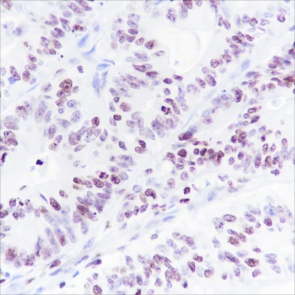 Recombinant Histone H1 (CT) Monoclonal Antibody (AGEL6477)