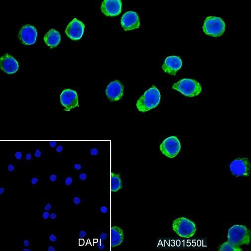 Recombinant HLA-DPA1 Monoclonal Antibody (AGEL6479)