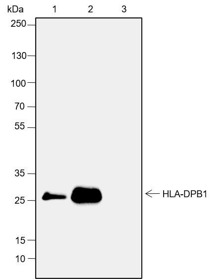 Recombinant HLA-DPB1 Monoclonal Antibody (AGEL6480)