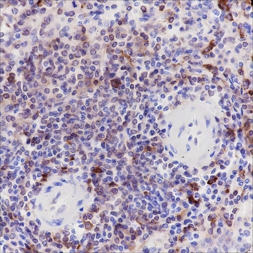 Recombinant HLA-DRA Monoclonal Antibody (AGEL6481)