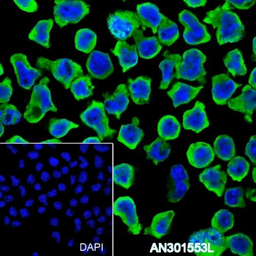 Recombinant HLA-DRB1 Monoclonal Antibody (AGEL6482)