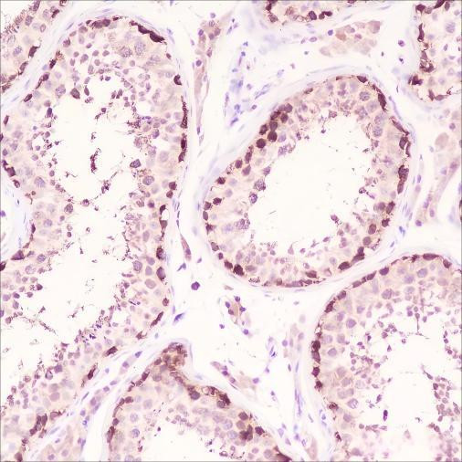 Recombinant HSP90 beta Monoclonal Antibody (AGEL6486)