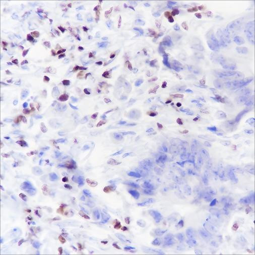 Recombinant IKAROS Monoclonal Antibody (AGEL6490)