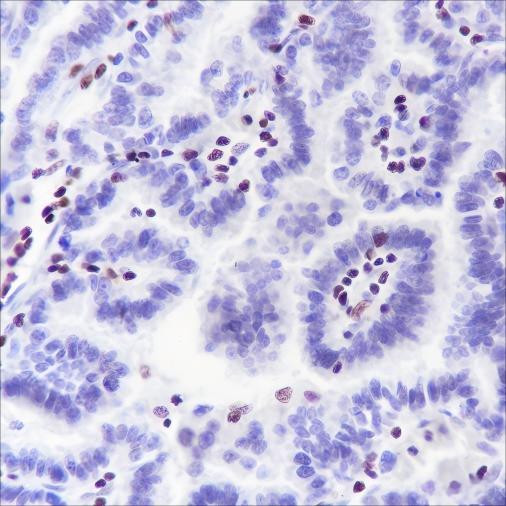Recombinant IKAROS Monoclonal Antibody (AGEL6490)