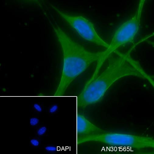 Recombinant IMPDH2 Monoclonal Antibody (AGEL6493)