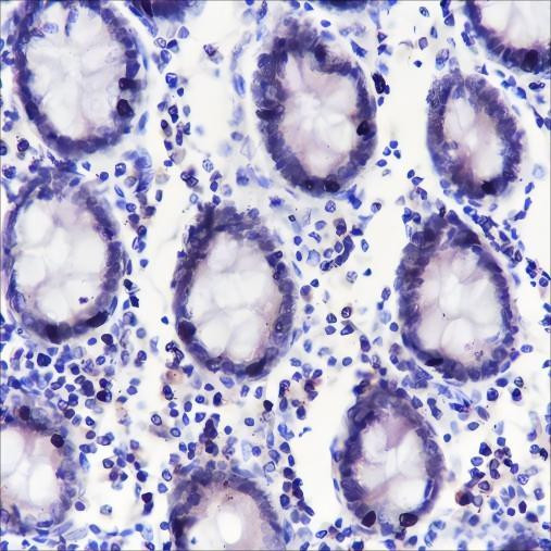 Recombinant ING5 Monoclonal Antibody (AGEL6494)
