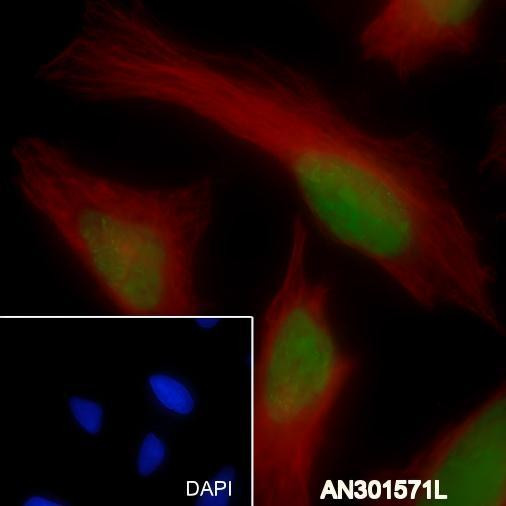 Recombinant JunB Monoclonal Antibody (AGEL6499)