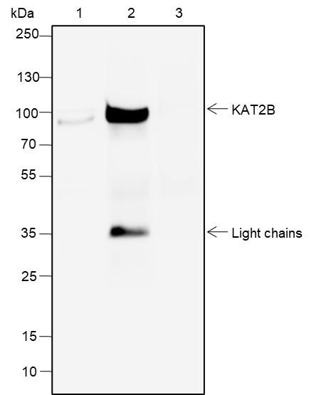 Recombinant PCAF Monoclonal Antibody (AGEL6500)