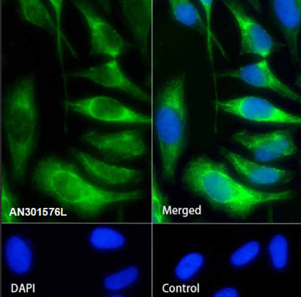 Recombinant Keratin 17 Monoclonal Antibody (AGEL6504)