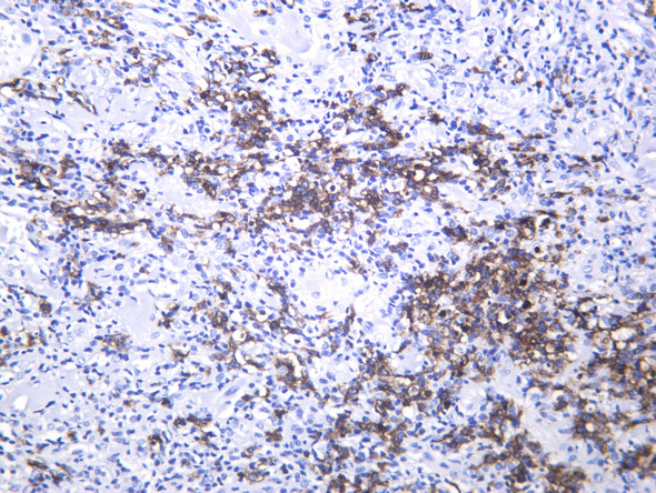 Recombinant Keratin 20 Monoclonal Antibody (AGEL6505)