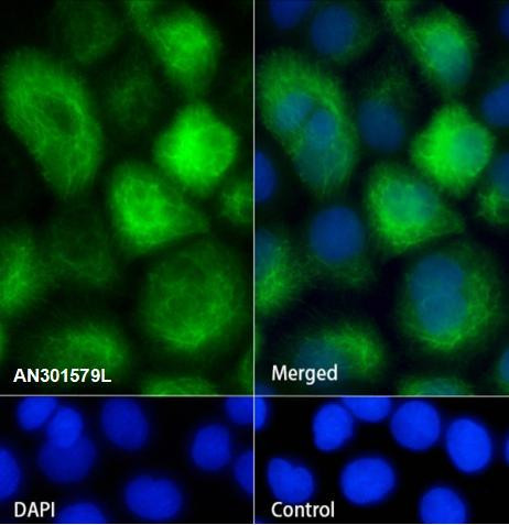 Recombinant Keratin 4 Monoclonal Antibody (AGEL6507)