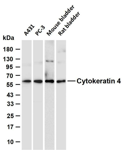 Recombinant Keratin 4 Monoclonal Antibody (AGEL6508)