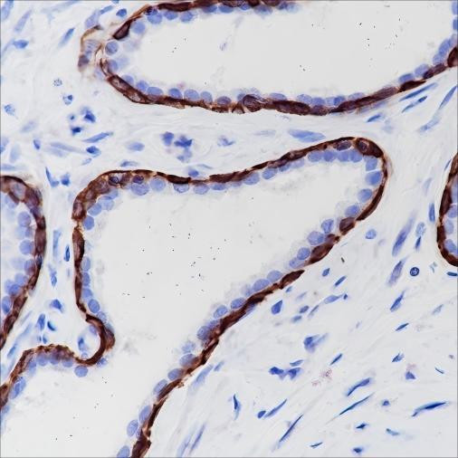 Recombinant Keratin 6 Monoclonal Antibody (AGEL6510)