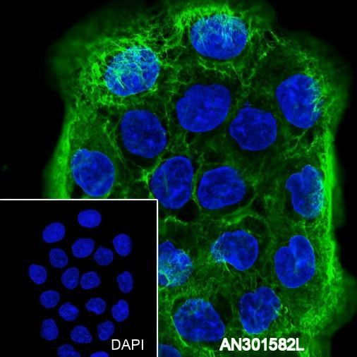 Recombinant Keratin 6 Monoclonal Antibody (AGEL6510)