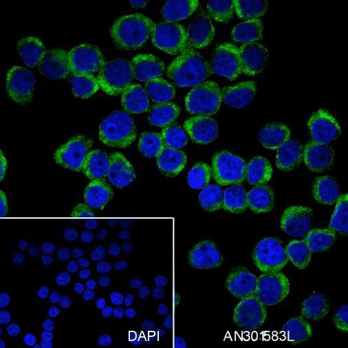 Recombinant KRAS Monoclonal Antibody (AGEL6511)