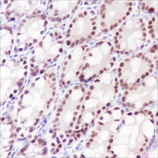 Recombinant Ku80 Monoclonal Antibody (AGEL6512)
