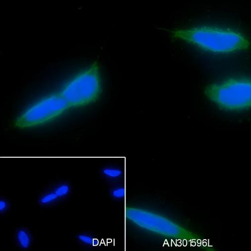 Recombinant MAP1LC3A Monoclonal Antibody (AGEL6524)