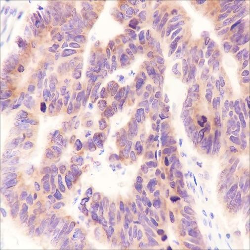 Recombinant MEK2 Monoclonal Antibody (AGEL6527)