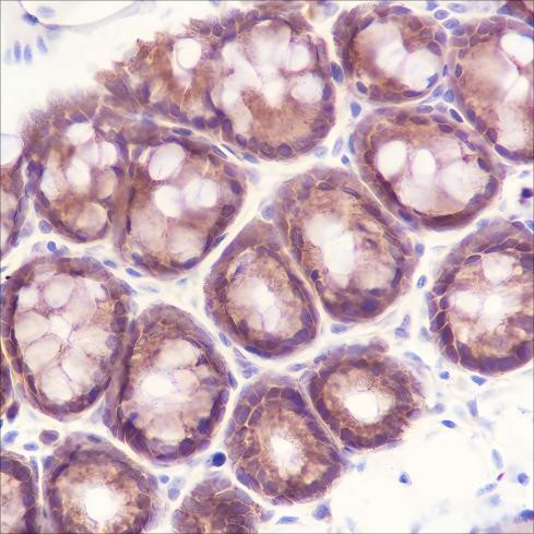 Recombinant MEK2 Monoclonal Antibody (AGEL6527)