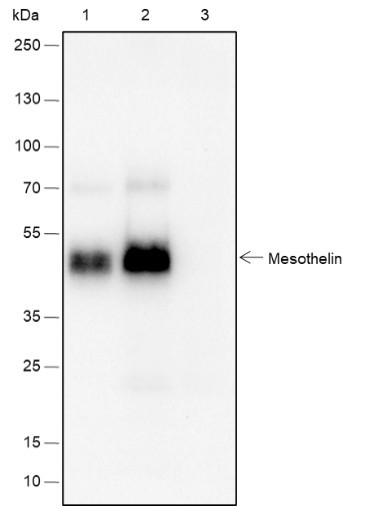 Recombinant Mesothelin Monoclonal Antibody (AGEL6528)