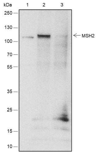 Recombinant MSH2 Monoclonal Antibody (AGEL6532)