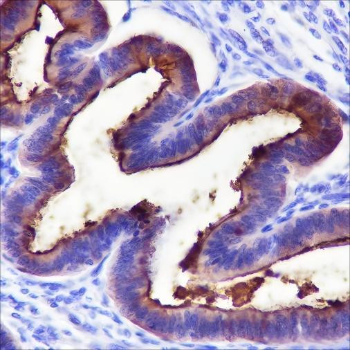 Recombinant MUC1 Monoclonal Antibody (AGEL6534)