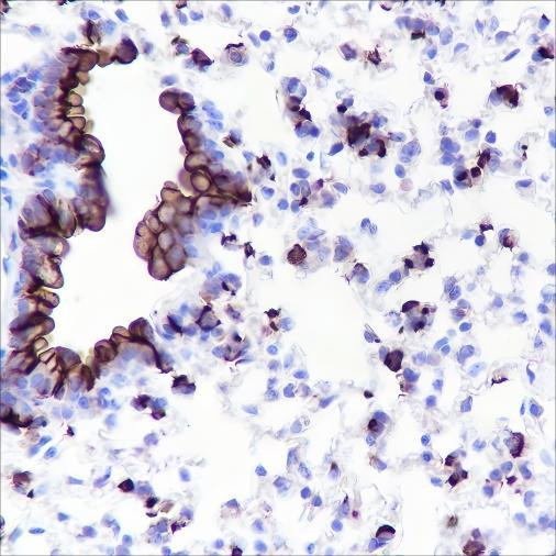 Recombinant MUC1 Monoclonal Antibody (AGEL6534)