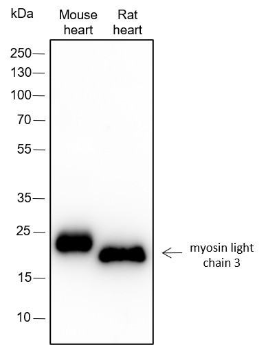 Recombinant Myosin Light Chain 3 Monoclonal Antibody (AGEL6535)