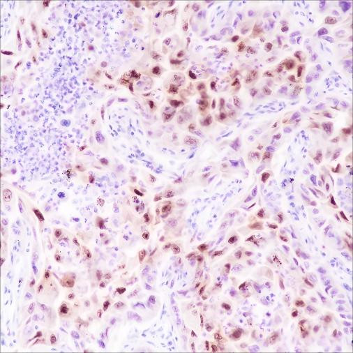 Recombinant CDKN2A/p14ARF Monoclonal Antibody (AGEL6543)