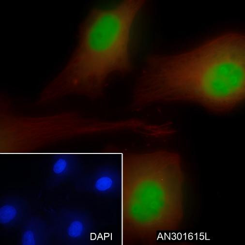 Recombinant CDKN2A/p14ARF Monoclonal Antibody (AGEL6543)
