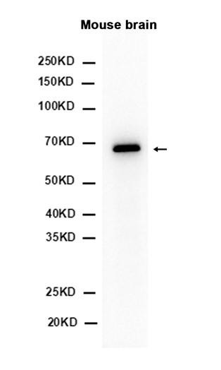 Recombinant PAK3 Monoclonal Antibody (AGEL6545)